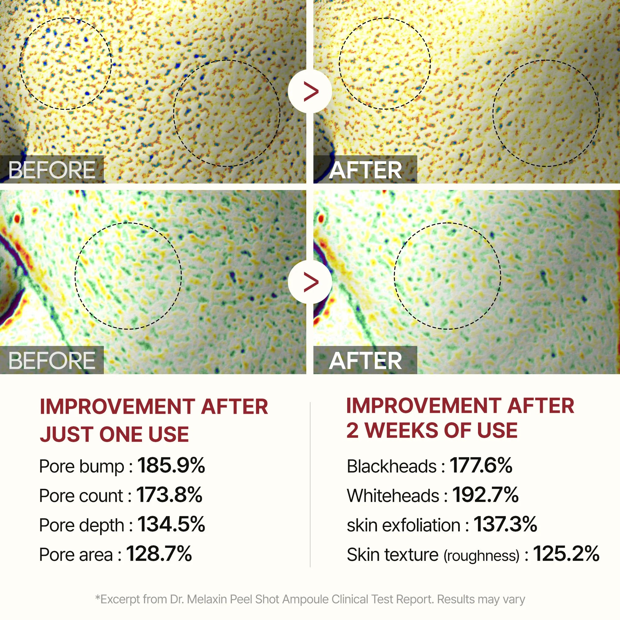 Peel Shot Glow Rice Line